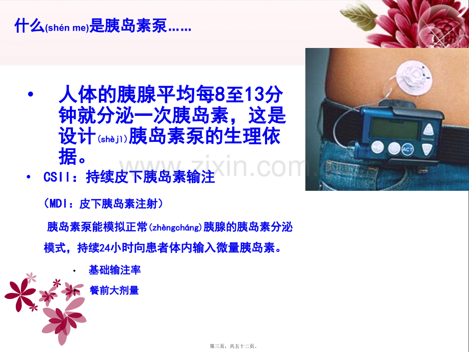 胰岛素泵的使用.ppt_第3页