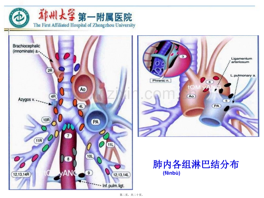 VATS左侧肺癌根治术中的淋巴结清扫---胸外科.ppt_第1页