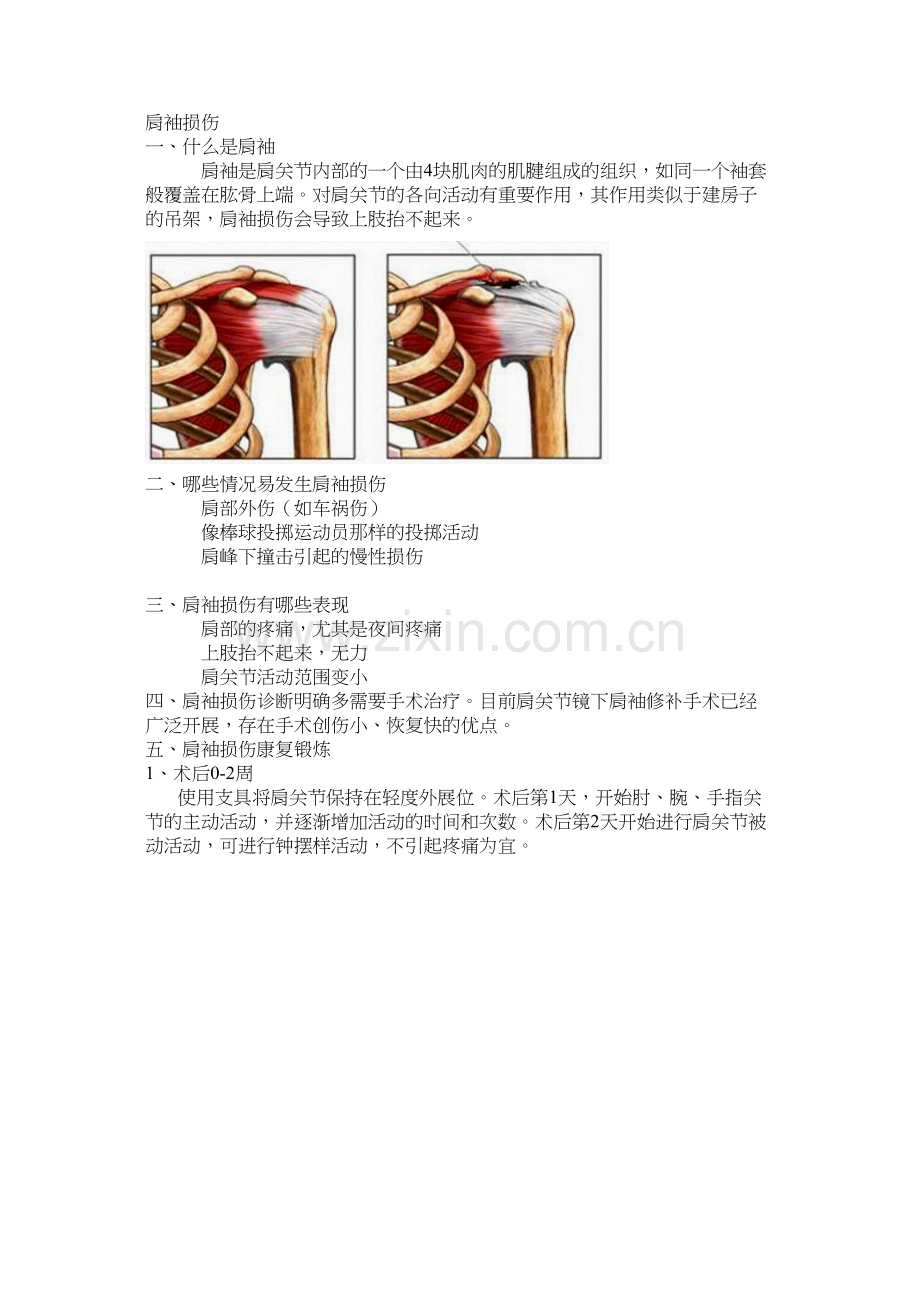 肩袖损伤术后康复.docx_第1页