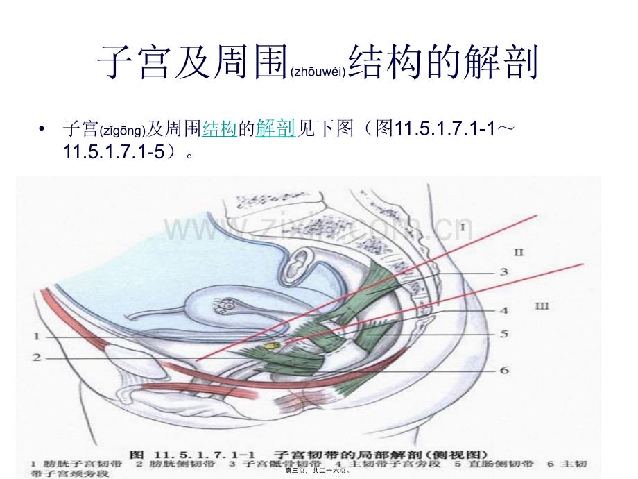 腹腔镜下全子宫切除术...ppt_第3页