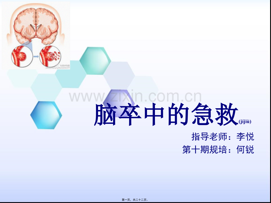 脑卒中的急救.ppt_第1页