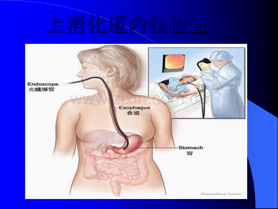 胃肠镜检查前后注意事项.ppt_第2页