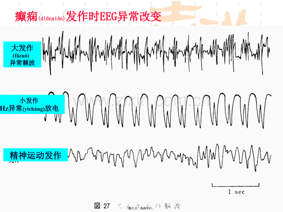 -抗癫痫药和抗惊厥药本-09.ppt_第3页