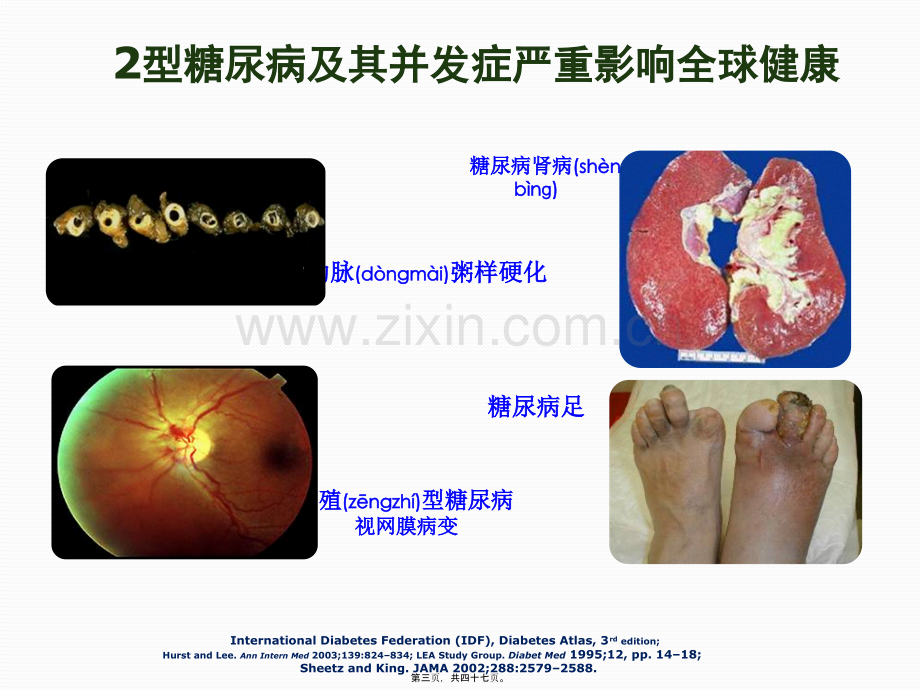 胰岛素分类及特点.pptx_第3页