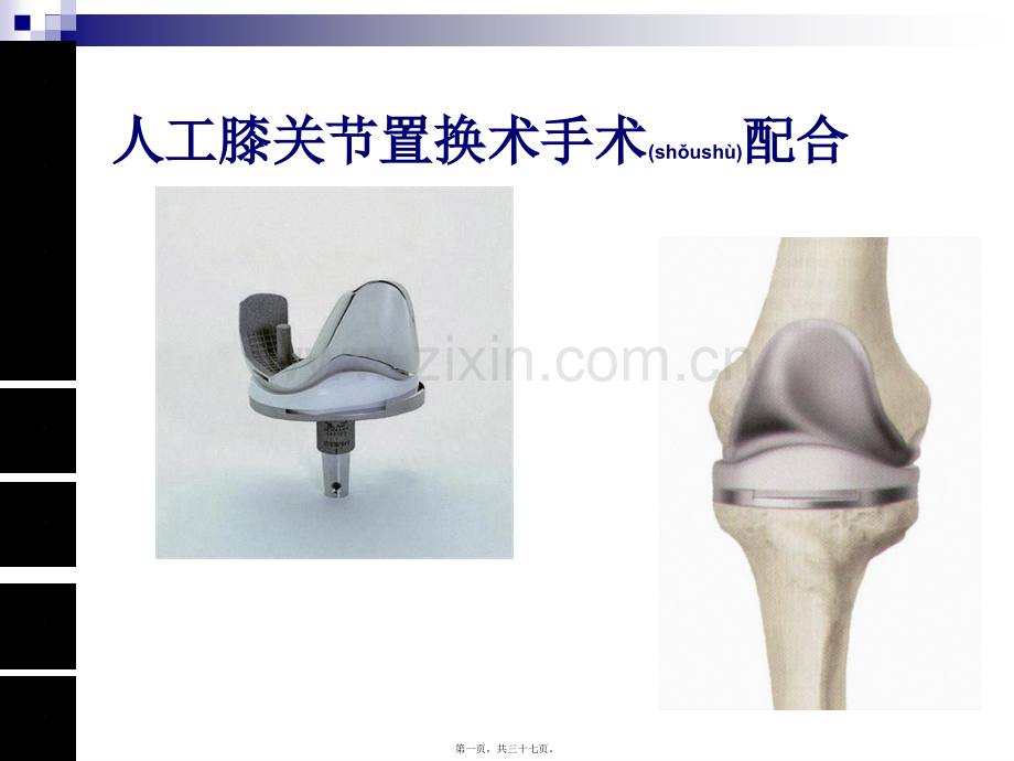 人工膝关节置换术手术配合ppt..ppt_第1页