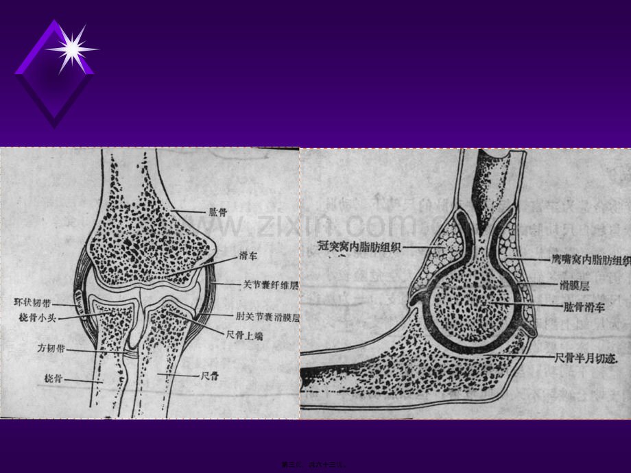 肘关节不稳定的诊治.ppt_第3页