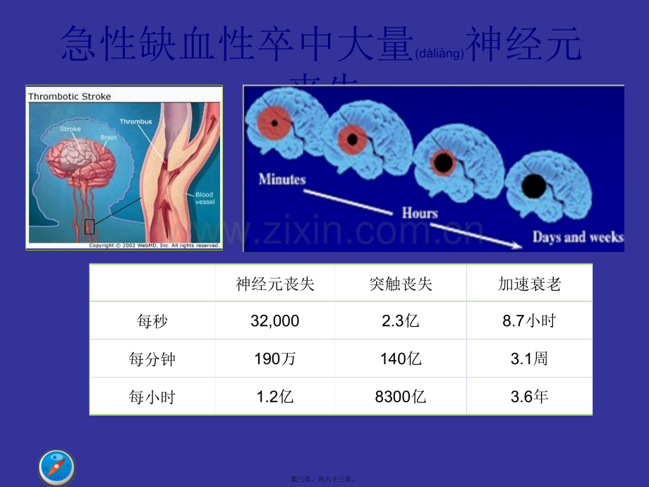 中国急性缺血性脑卒中诊治指南(古城).ppt_第3页