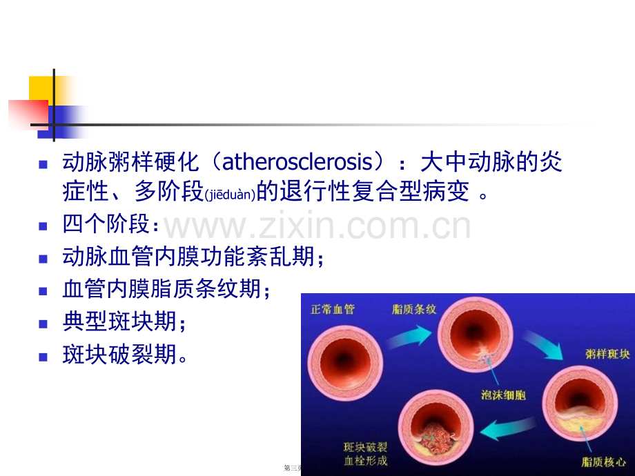 人卫第七版营养与动脉粥样硬化性心脏病.ppt_第3页