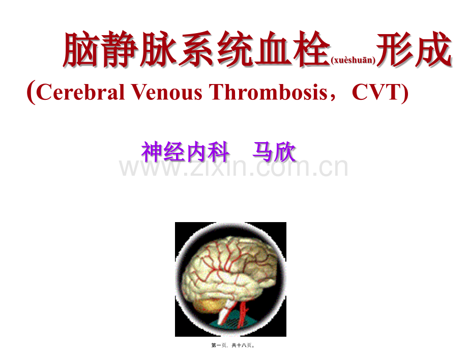 脑静脉系统血栓形成幻灯片.ppt_第1页