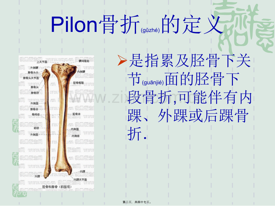 Pilon骨折的诊治现状与进展.ppt_第2页