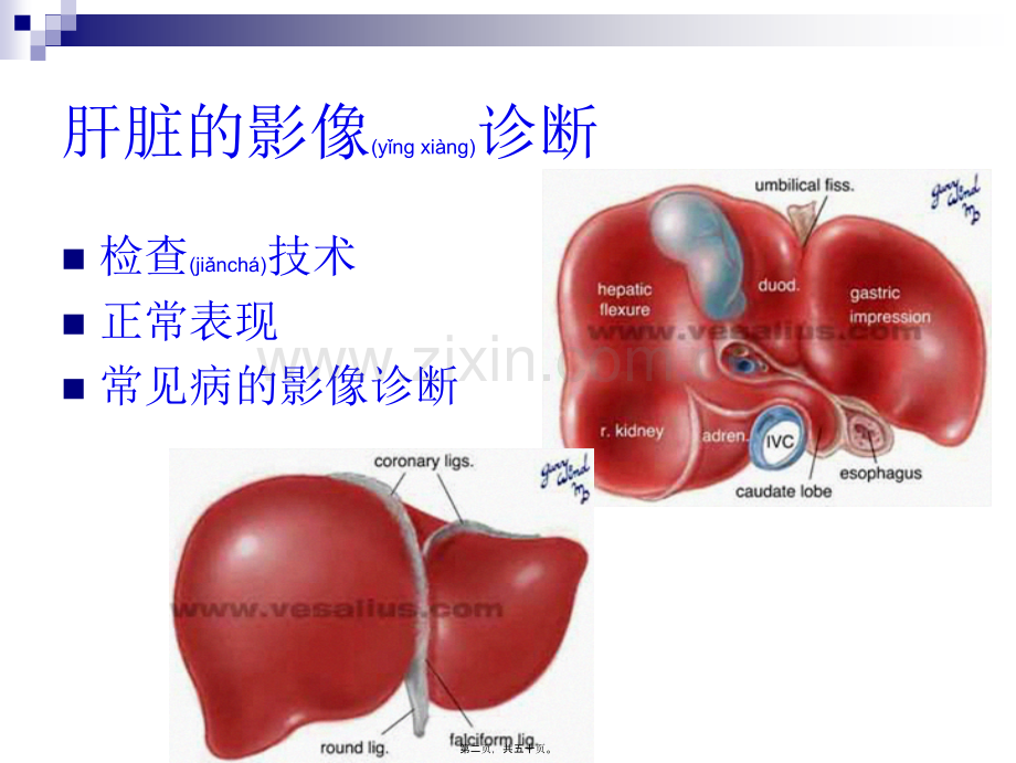 肝胆胰脾影像表现.ppt_第2页