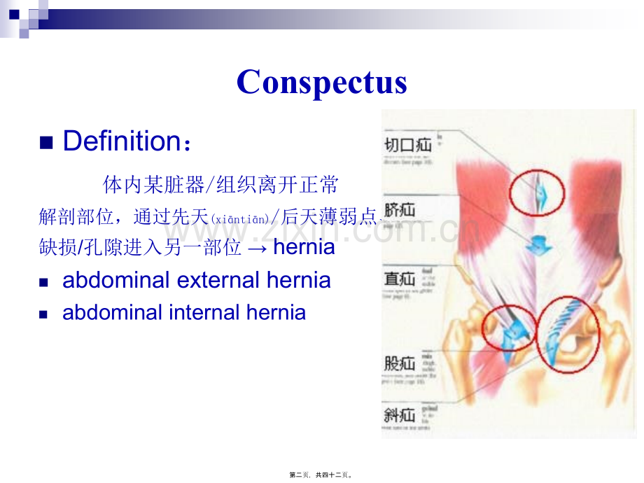 腹外疝(上网版).ppt_第2页