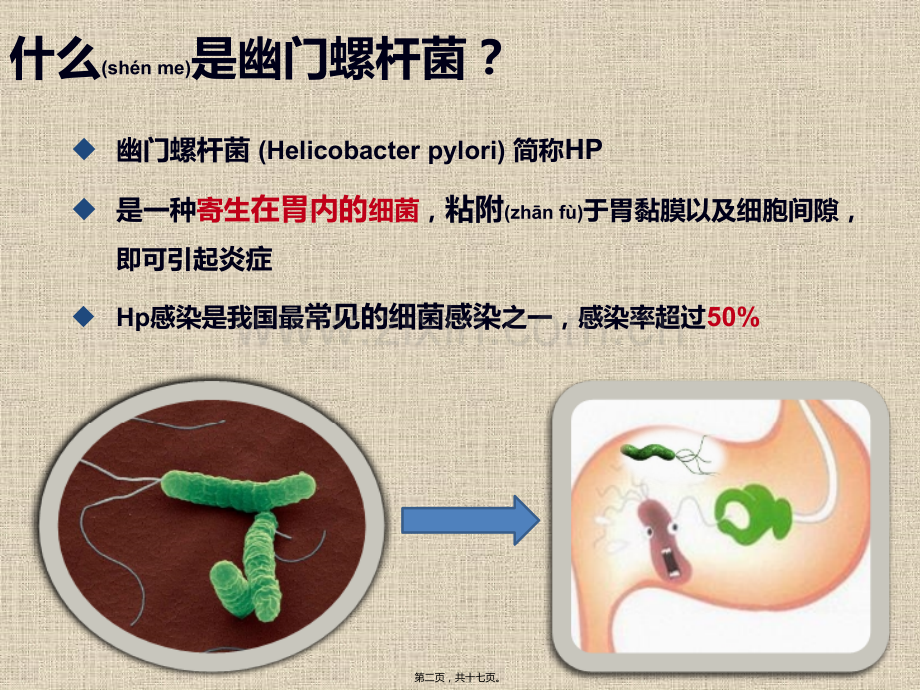 胃的不速之客—幽门螺杆菌.pptx_第2页