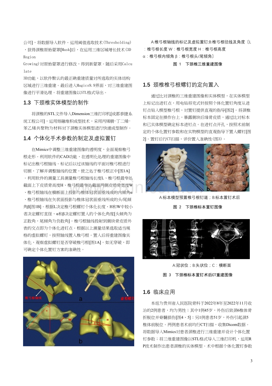 Mimics及脊柱模型用于下颈椎椎弓根个体化置钉的应用研究.docx_第3页