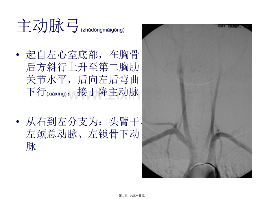 学术讨论—脑血管的正常变异及异常.ppt_第2页