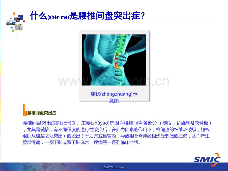 学术讨论—腰椎间盘突出症科普介绍.ppt_第2页