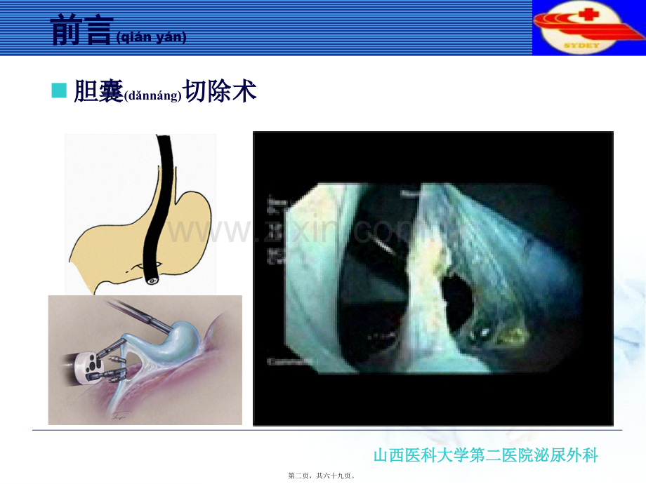 NOTES经自然腔道内镜手术.ppt_第2页