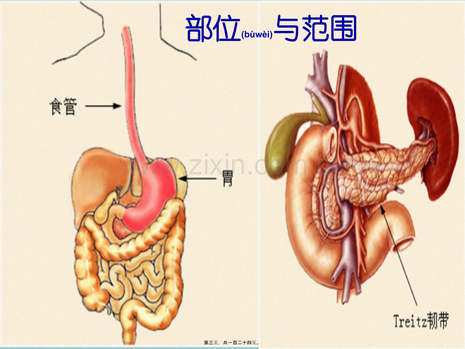 上消化道出血120汇编.ppt_第3页