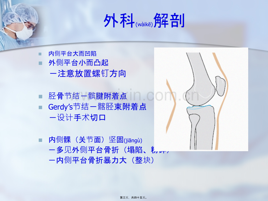 学术讨论—胫骨平台骨折(终).ppt_第3页