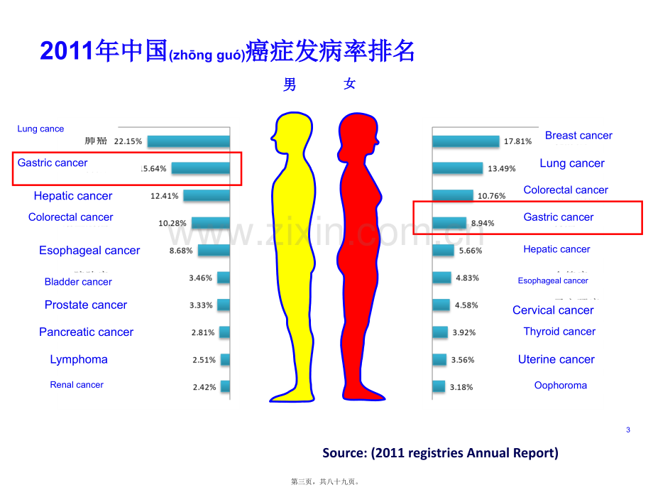 胃癌综合诊治第3版.ppt_第3页