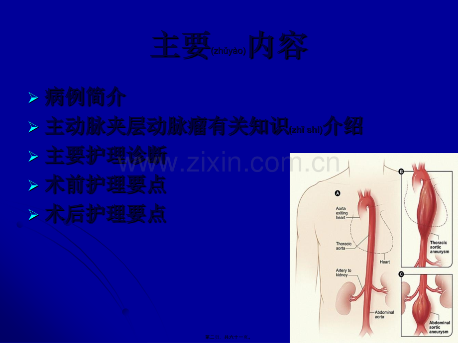 主动脉夹层动脉瘤围手术期教学查房.ppt_第2页