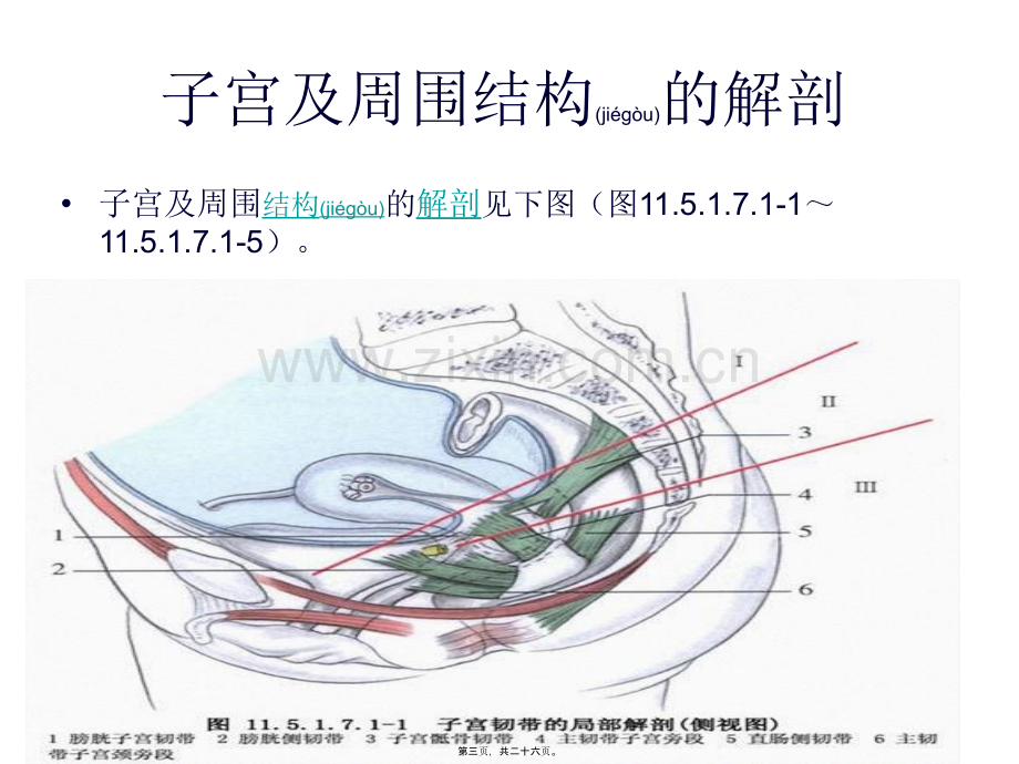 腹腔镜下全子宫切除术分析.ppt_第3页