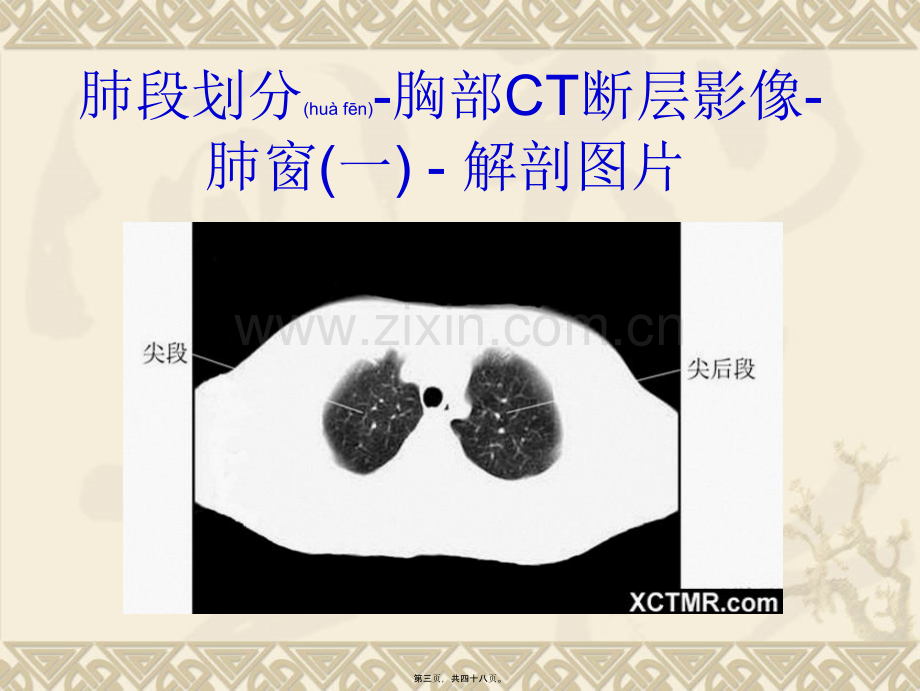 胸、上腹和盆腔CT详细实用图解.ppt_第3页