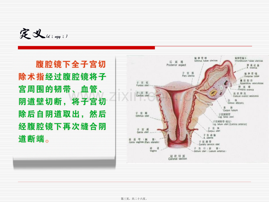 腹腔镜子宫切除术-2.ppt_第3页