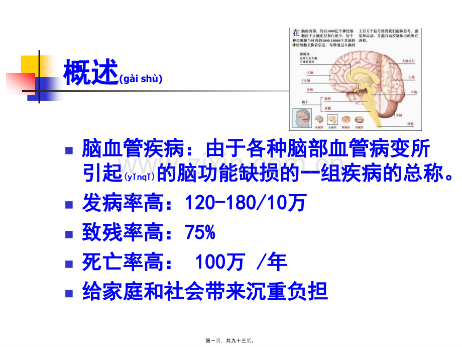 脑血管病1.ppt_第1页