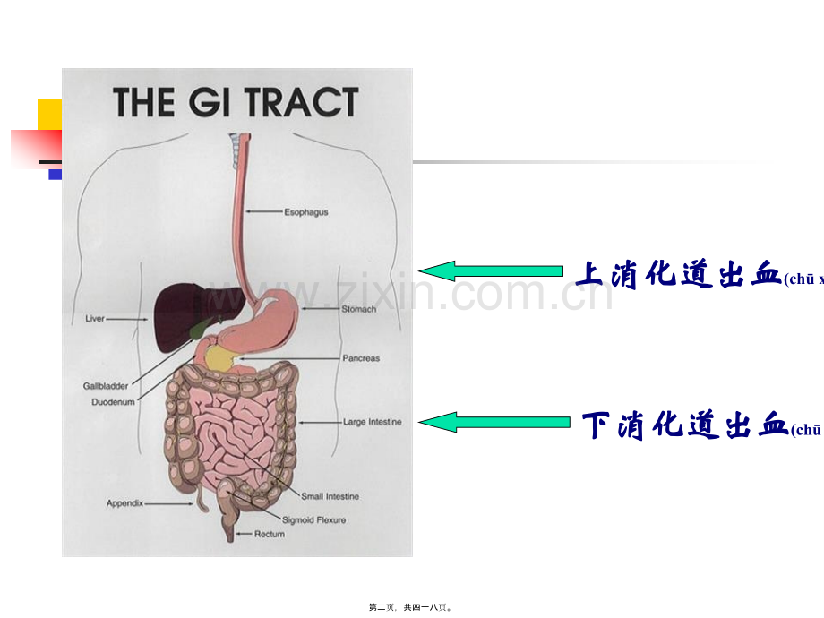 上消化道大出血2014.ppt_第2页