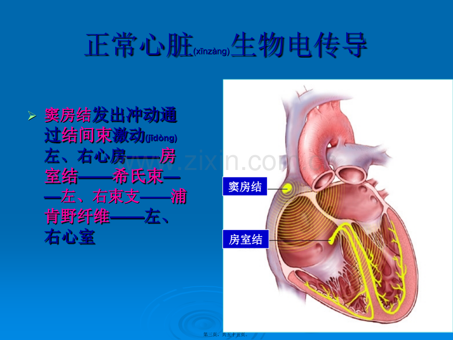 人工心脏起搏器.ppt_第3页