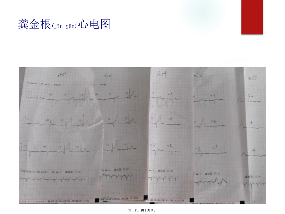 胸痛中心质量分析6.pptx_第3页