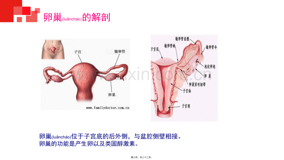 腹腔镜下卵巢囊肿剥除术配合.pptx_第3页