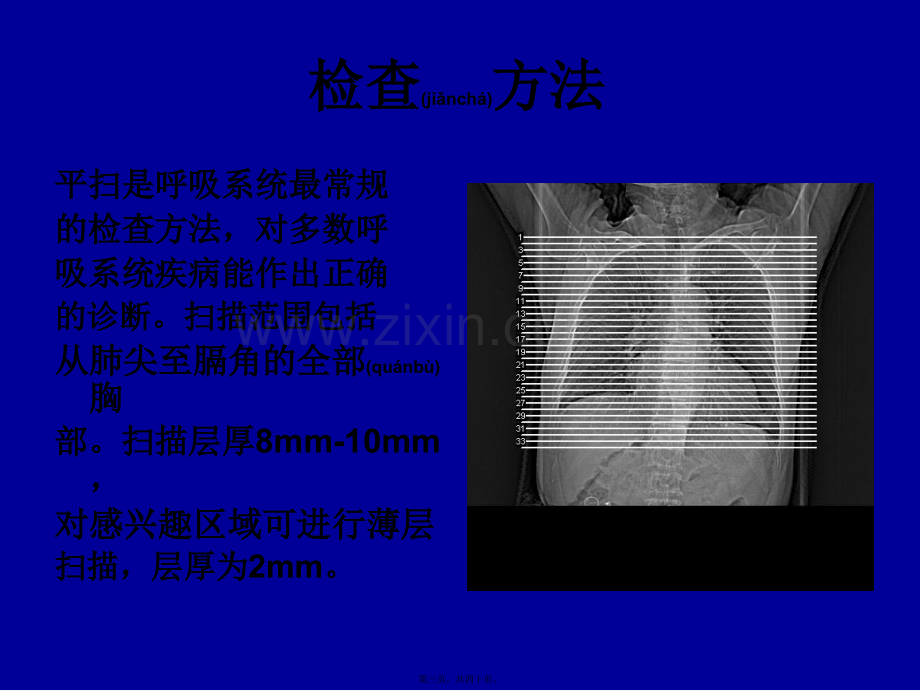 胸部CT基础知识.ppt_第3页