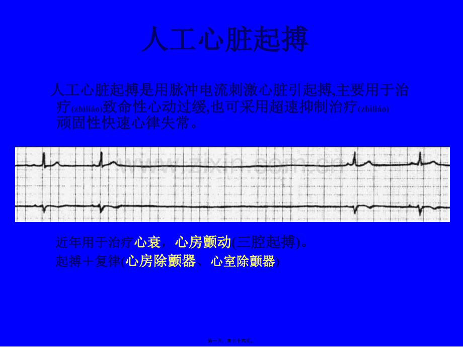 人工心脏起搏03417ppt.ppt_第1页