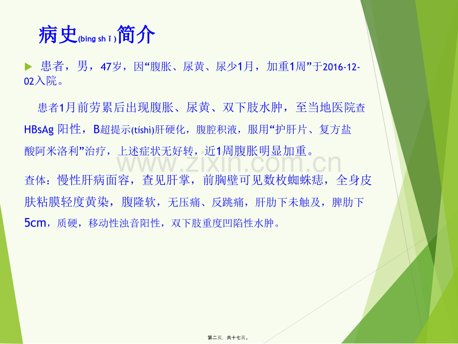 肝硬化病例分享.ppt_第2页