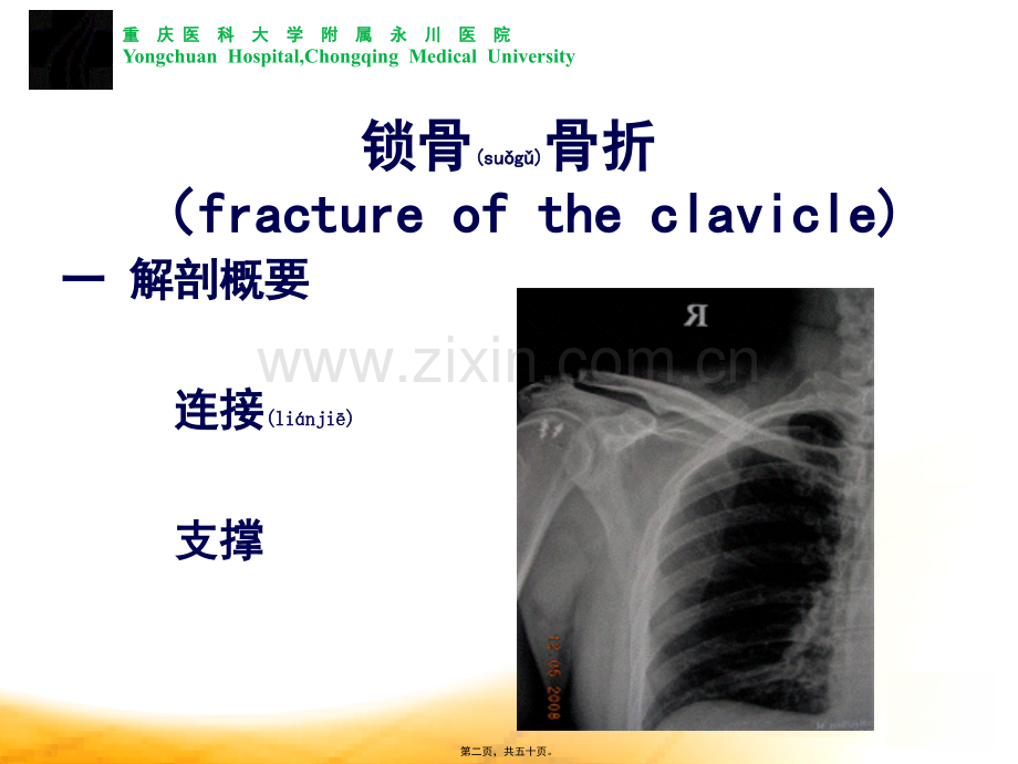 上肢骨折脱位.ppt_第2页