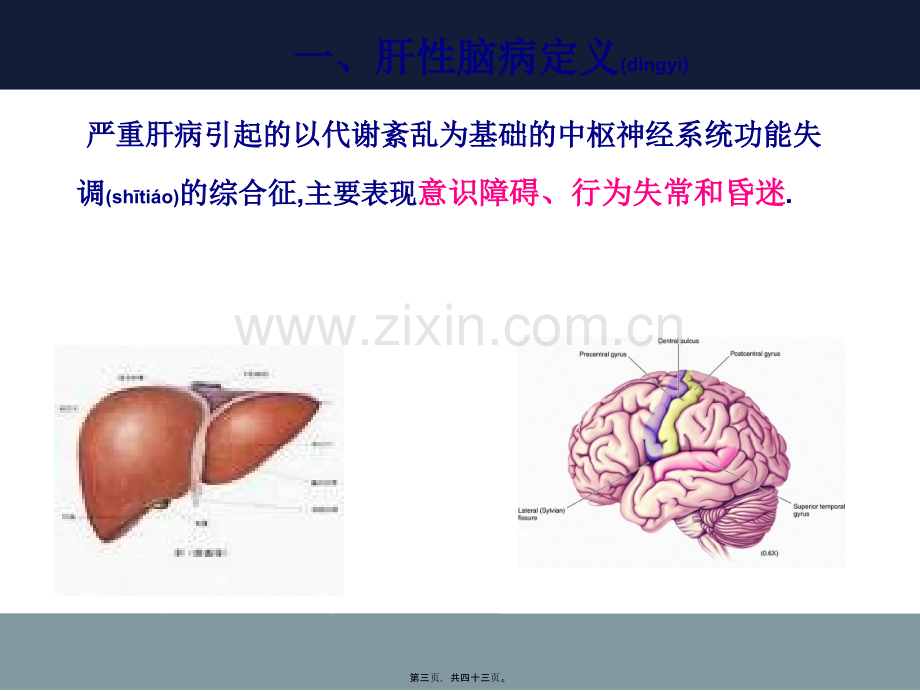 肝--性--脑--病.ppt_第3页