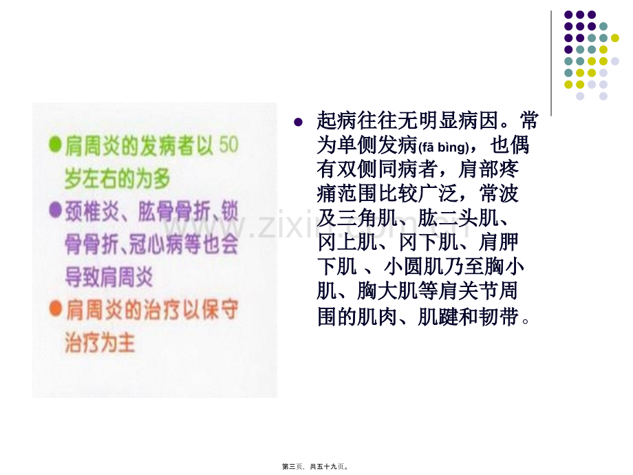 学术讨论—肩周炎康复详解.ppt_第3页