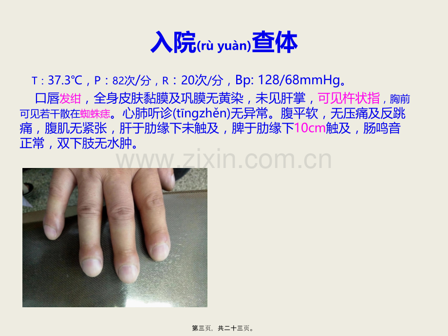 肝硬化合并肝肺综合征.ppt_第3页