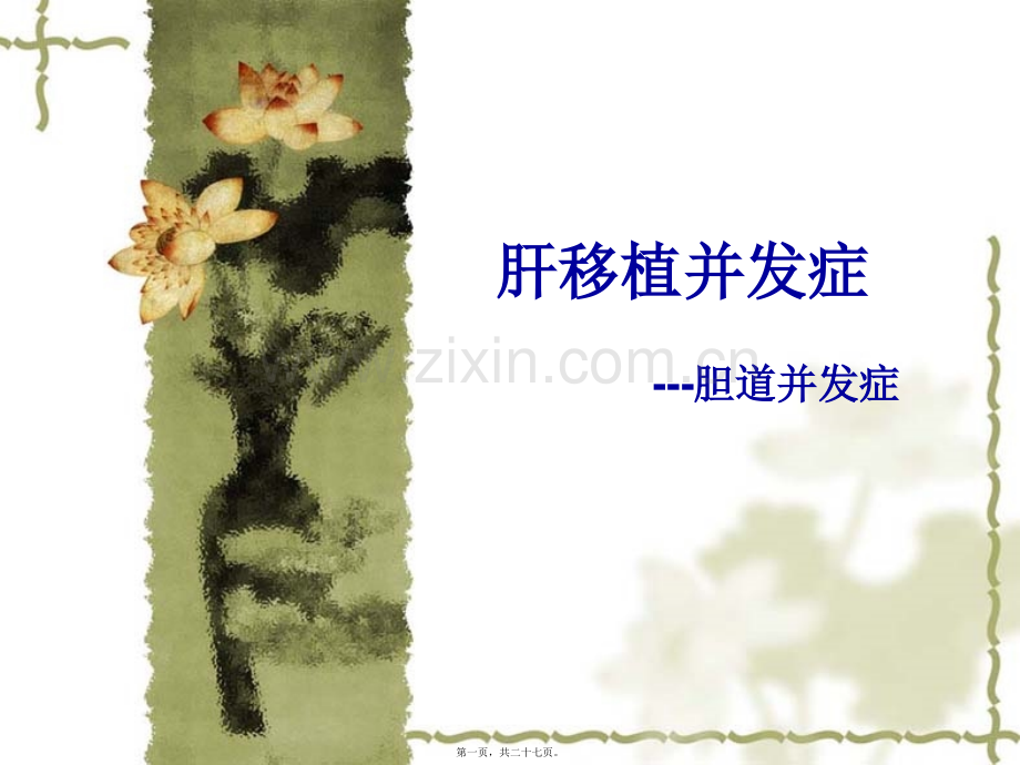 肝移植并发症--胆道并发症.ppt_第1页