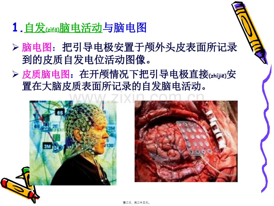 脑的高级机能.ppt_第2页