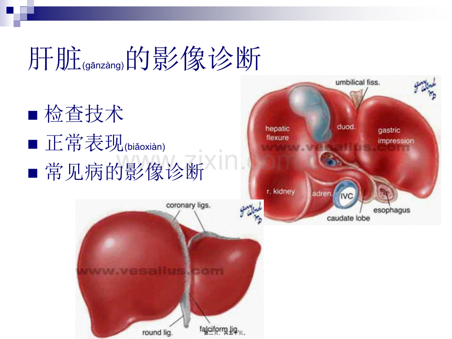 肝胆胰脾影像表现分析.ppt_第2页