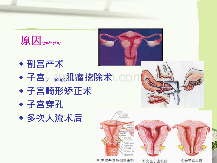 产后出血指南2014-镇海2015.ppt_第3页