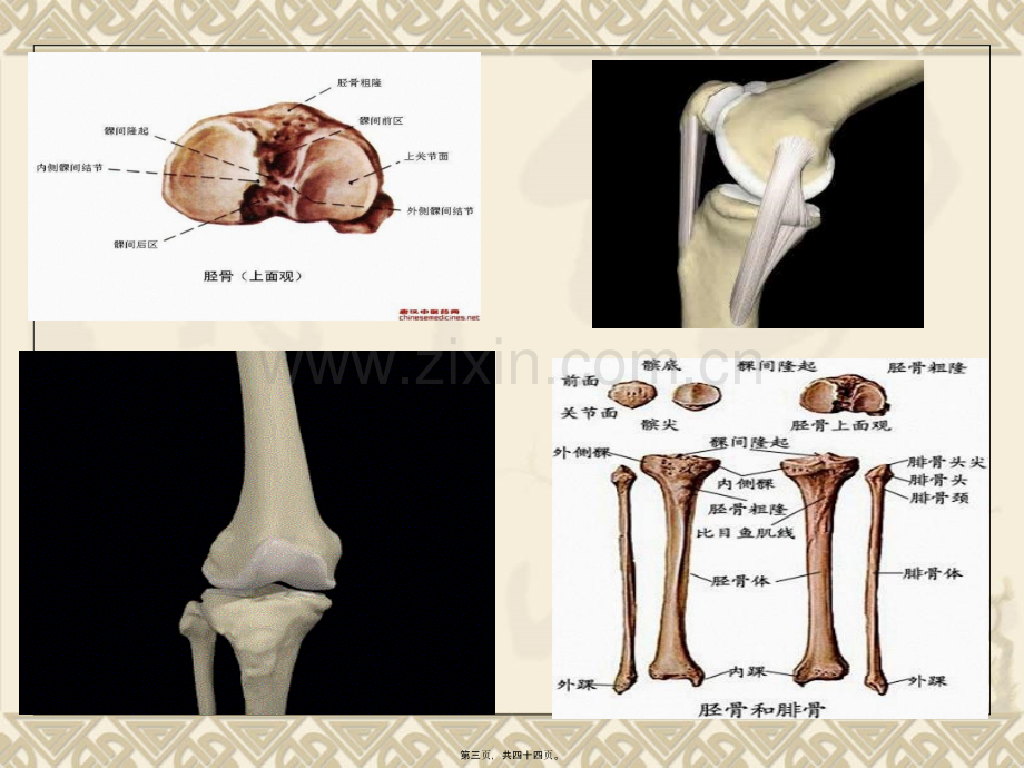 胫骨平台骨折PPT.ppt_第3页