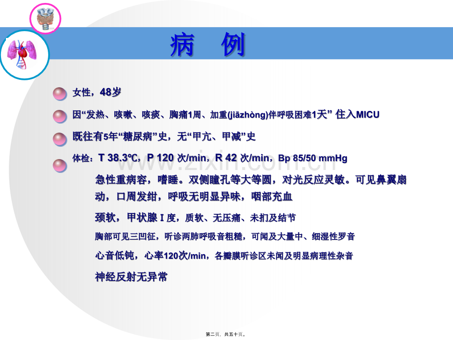 学术讨论—NTIS-甲状腺功能正常病态综合征.ppt_第2页