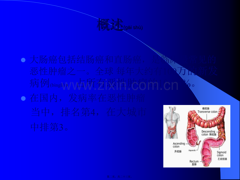 结肠癌术后辅助化疗.ppt_第2页