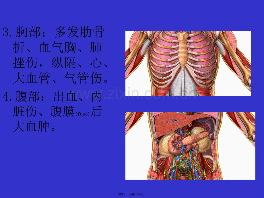 第五讲多发伤急救.ppt_第3页