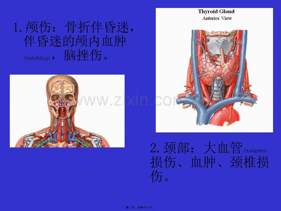 第五篇多发伤急救.ppt_第2页