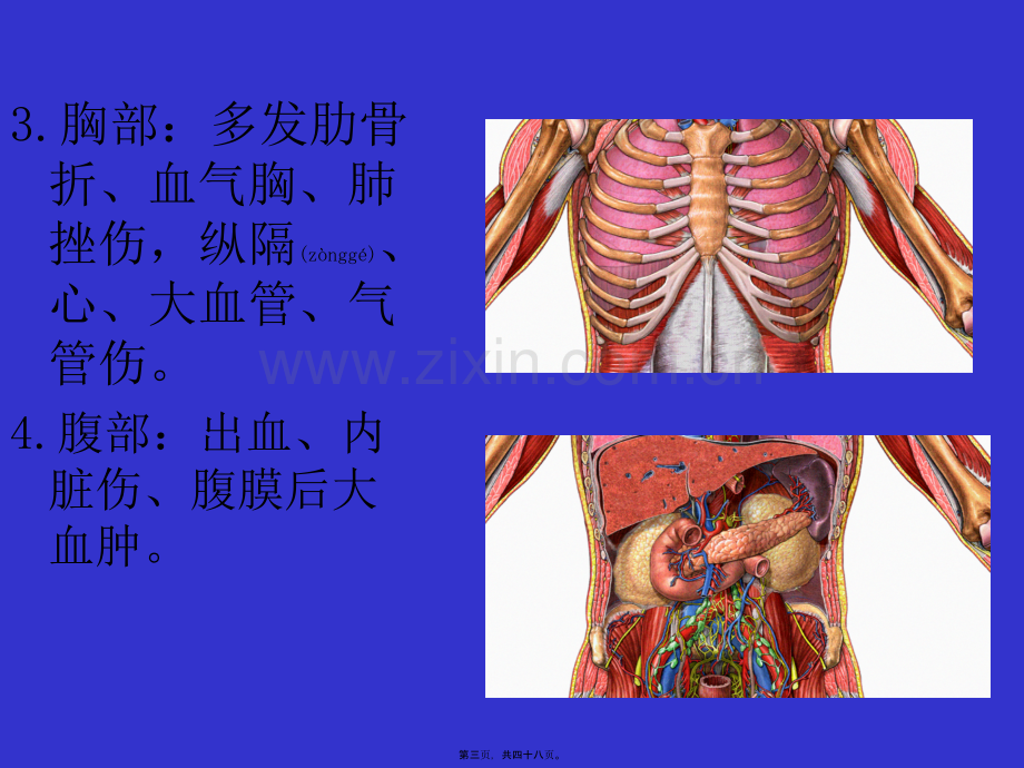 第五篇多发伤急救.ppt_第3页